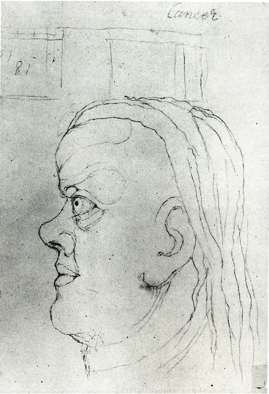 Blake Visionary Head of Cancer Smaller