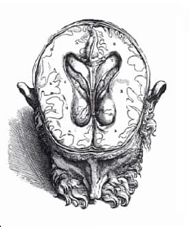 Andreas Vesalius De Humani Corporis Fabrica, Plate 7 of Book VII